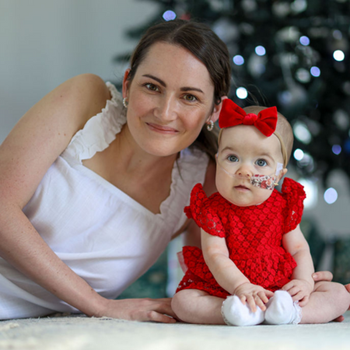 Baby born with organs outside her body is a Christmas miracle